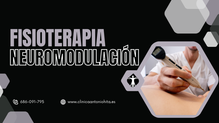 neuromodulación